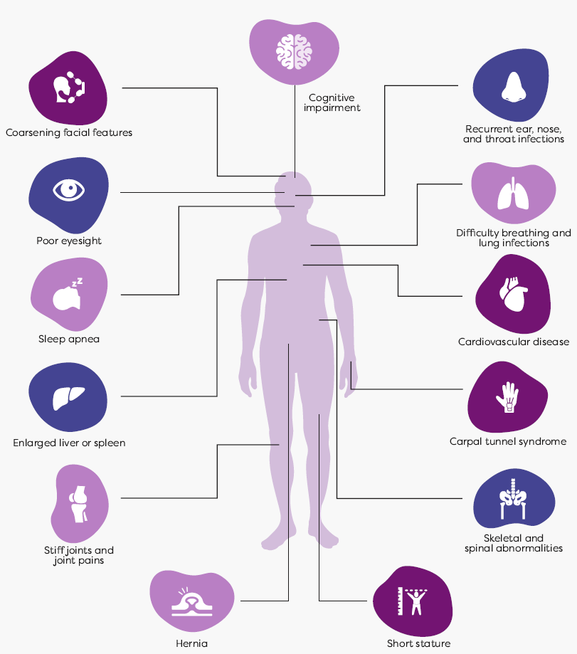 Signs and Symptoms | Aldurazyme Patient